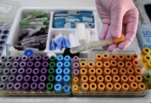 На Ямале утвердили программу по проведению генетических исследований жителям округа