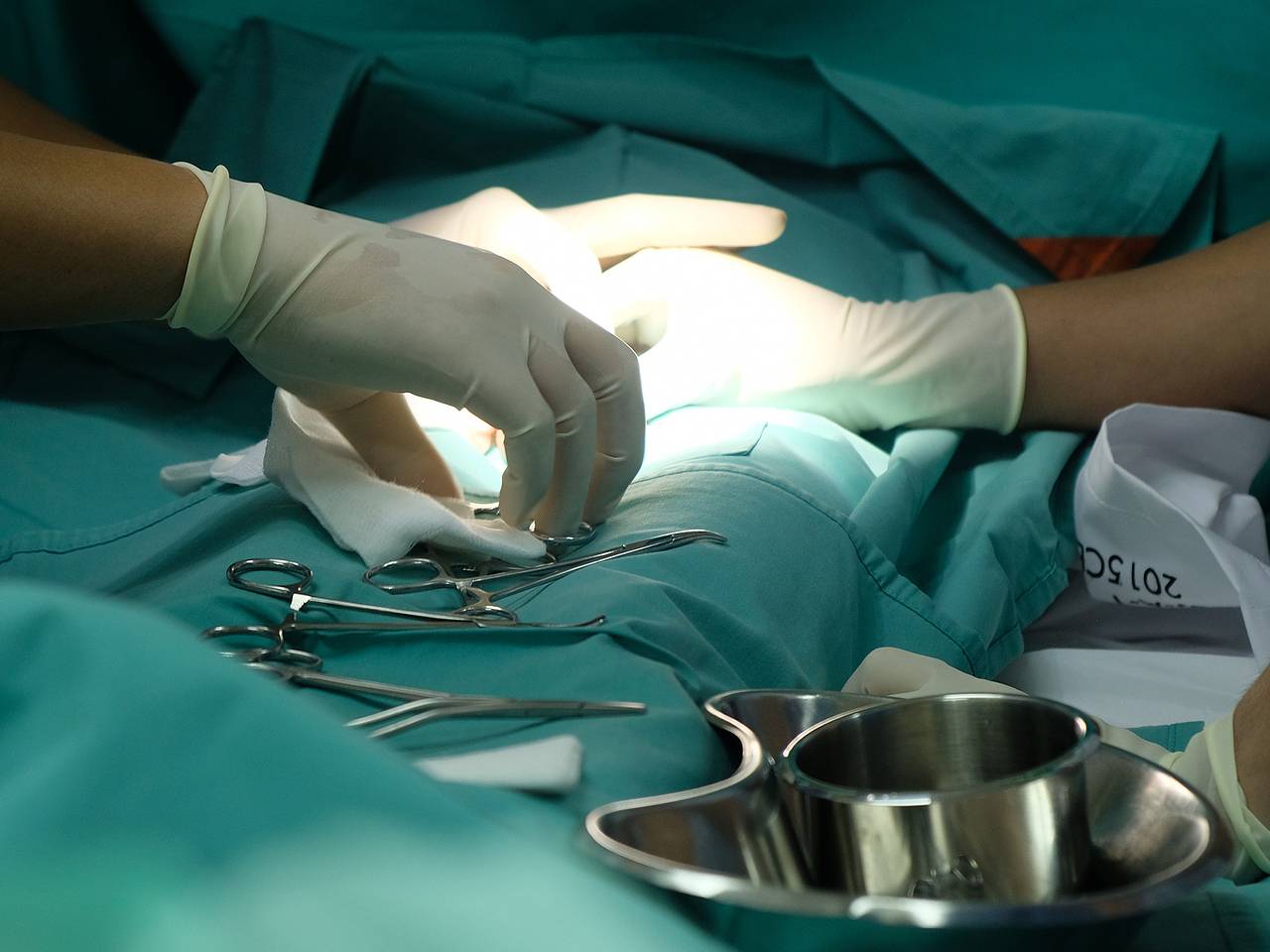 Российские врачи спасли женщину с огромной опухолью